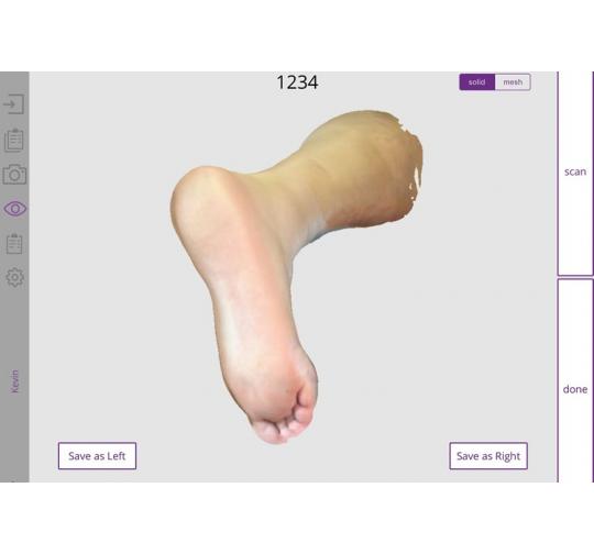 Orthotics Using 3D Foot Scanning